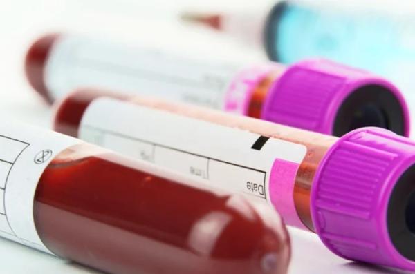 
        Вирус застревает. Врач Бережанский назвал, почему ветрянкой лучше не болеть    