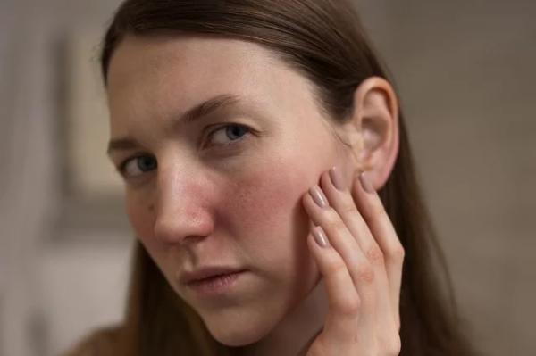 
        Темные пятна. Врач Алифанова рассказала, опасна ли «маска беременности»    