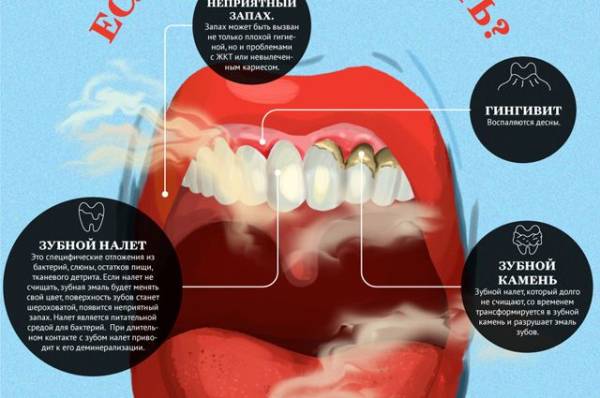 
        Удалять или нет? Врач Шипков рассказал, зачем нужны зубы мудрости    