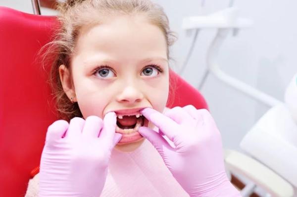 
        Удалять или нет? Врач Шипков рассказал, зачем нужны зубы мудрости    